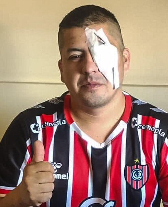ANALIZAN PEDIR LA RECALIFICACIÓN DE LA CAUSA DEL HINCHA DE CHACARITA QUE PERDIÓ UN OJO